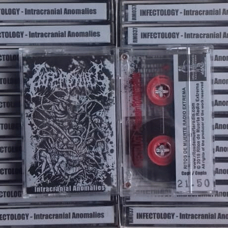 Infectology : Intracranial Anomalies